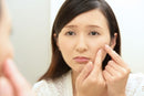 【皮膚科医監修】繰り返す大人ニキビの原因とは
