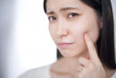 【皮膚科医監修】敏感肌とは？肌の状態を正しく知ろう